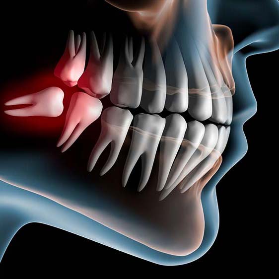 Chirurgia orale Brindisi - Centro Odontoiatrico Atena